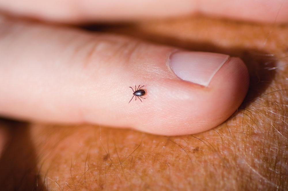RIVM warns of increasing tick bite cases in the Netherlands