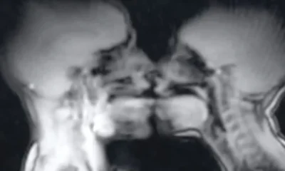 Effects of sexual intercourse observed in MRI scan