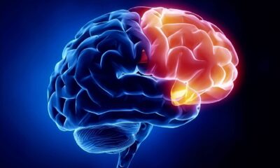 Traumatic memories from the distant past are stored in the anterior part of the brain