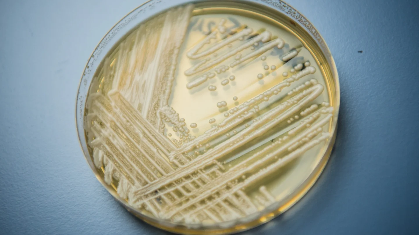 Drug resistant fungal disease spreading in the US