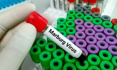 Marburg virus caused 2 more deaths