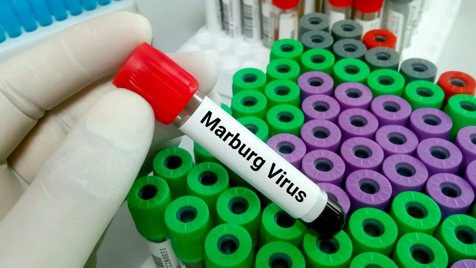 Marburg virus caused 2 more deaths